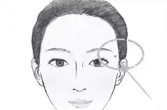 5 nốt ruồi "Đế Vương" càng già càng giàu: Ai có 1/5 cũng viên mãn cả đời, rất đáng chúc mừng