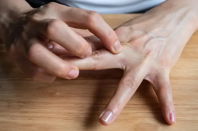 2 bộ phận trên cơ thể hay ng:ứa ng:áy là dấu hiệu UT g:an, nhiều người dễ lầm tưởng là d:ị ứ:ng