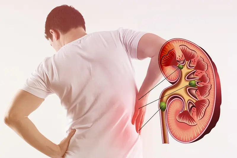 8 dấu hiệu suy thận giai đoạn đầu bạn không nên bỏ qua