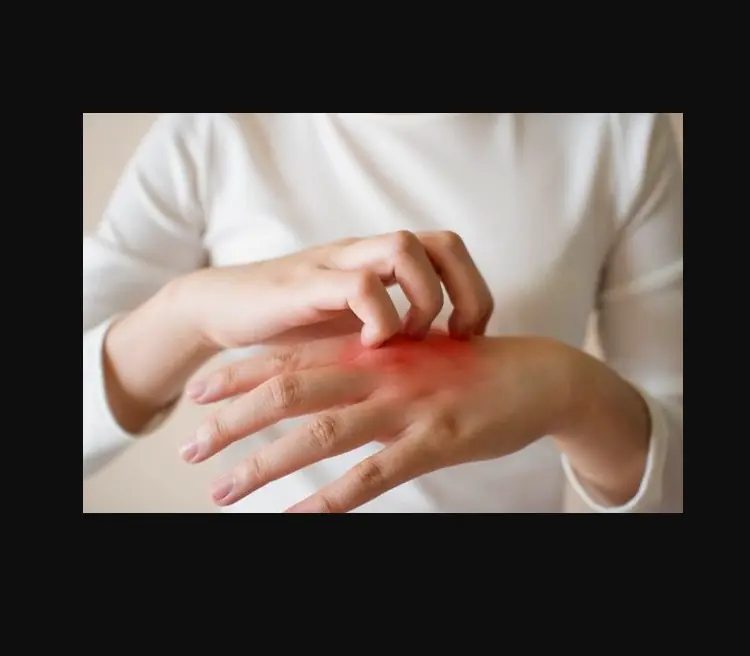 Bị ngứa vào ban đêm, đi khám mới biết chỉ còn sống được 8 tháng