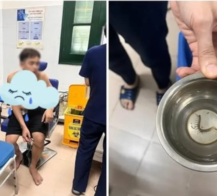 Rết chui vào tai khi đang chạy lũ ở Thái Nguyên: Nam sinh chảy máu, phát sốt vì đau buốt