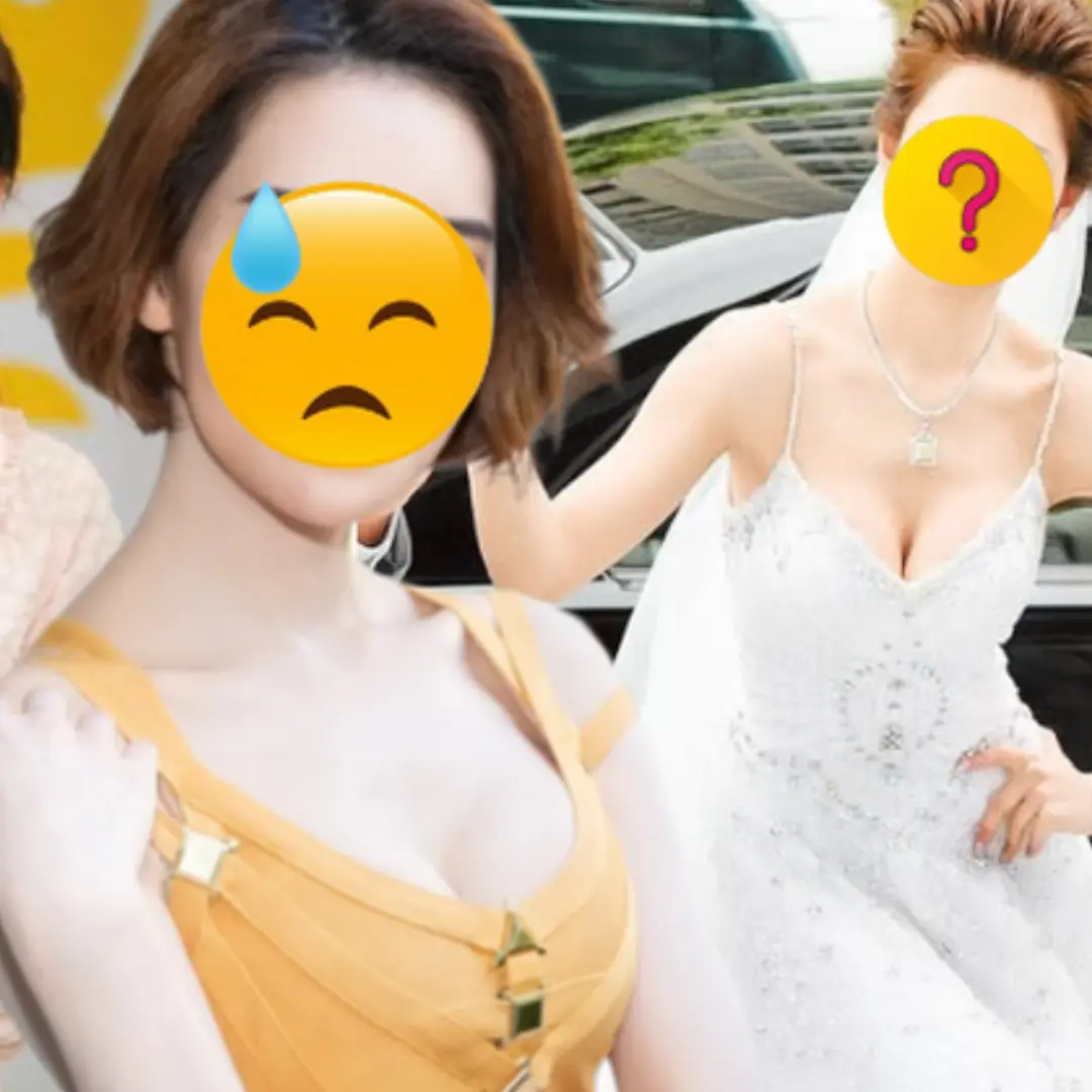 Nữ diễn viên không đánh răng suốt 1 năm: Hứng chịu hậu quả k:i:n:h h:o:àng, lí do gây bất ngờ