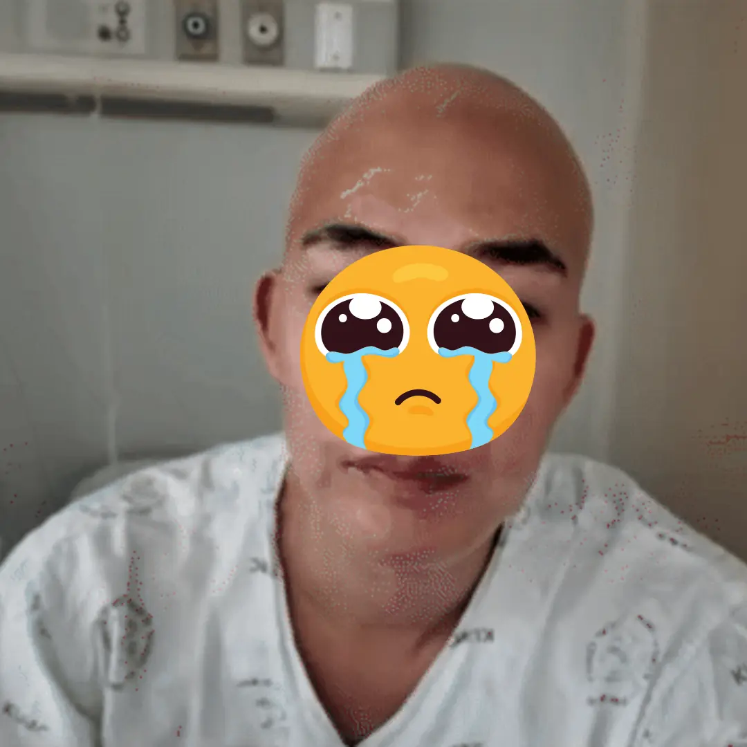 Mỹ nam Địa Ngục Độc Thân sau khi điều trị UT 🩸, mặt tiều tụy, người gầy rộc