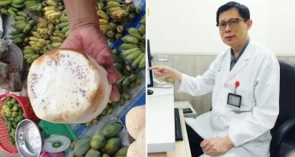 5 loại quả này nằm trong sách đen’ gây bệnh nuôi tế bào UT: Dù rẻ mấy cũng đừng mua ăn