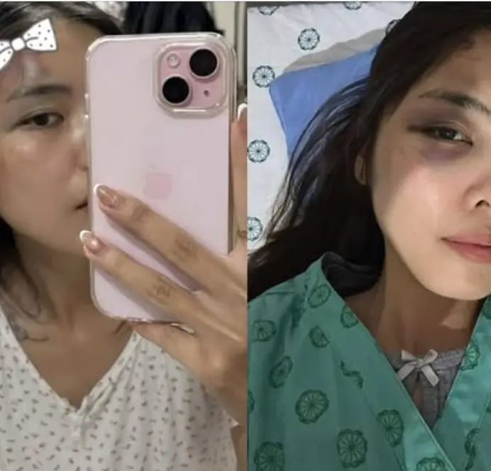 Người vợ bị chồng đánh thủng màng nhĩ, chấn động não tại Hà Nội hé lộ tình tiết phẫn nộ, vợ cũ ra mặt vạch trần bản chất người đàn ông