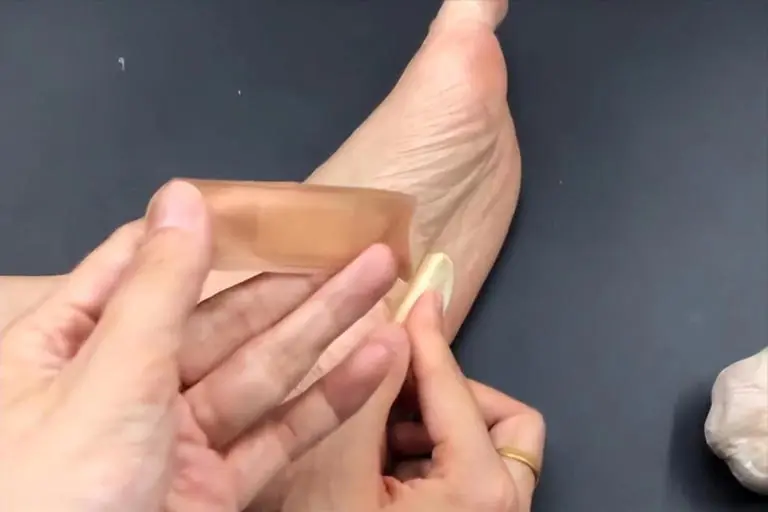 Người phụ nữ 56 tuổi dán tỏi vào lòng bàn chân suốt 6 tháng, kết quả khám sức khỏe khiến bác sĩ "ngã ngửa"