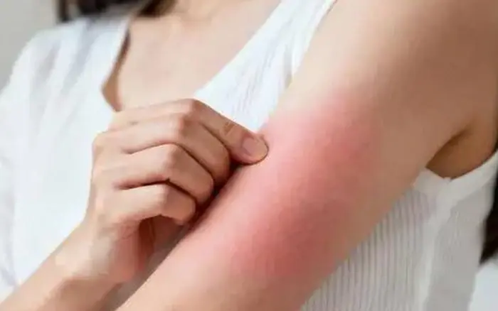 Đừng đợi đến khi phù nề mới đi khám! Bác sĩ chỉ ra 3 dấu hiệu sớm của bệnh thận mà 90% người bỏ qua